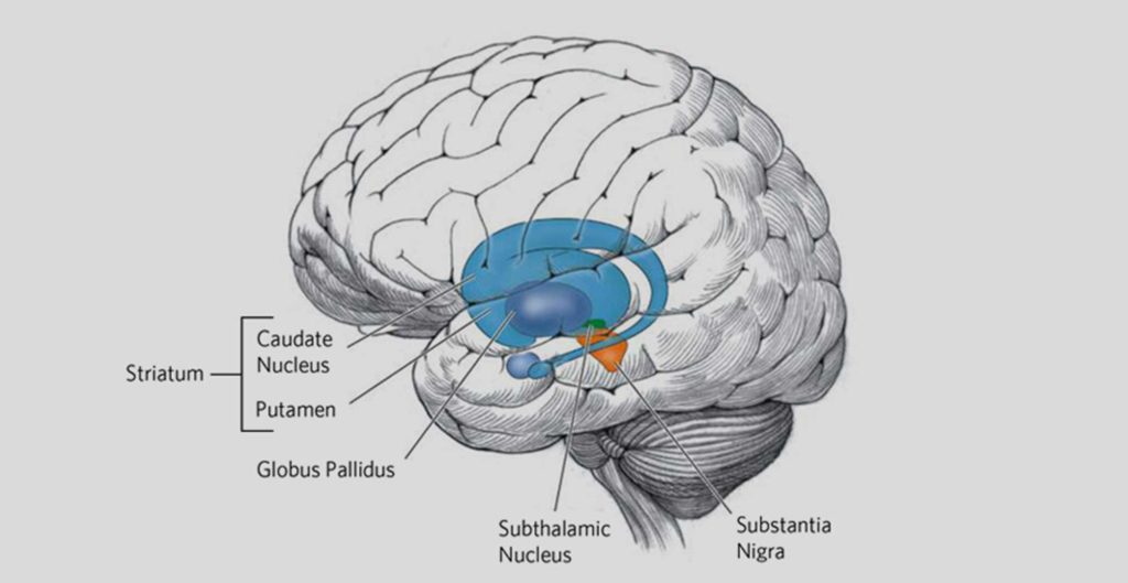 Huntington's Disease