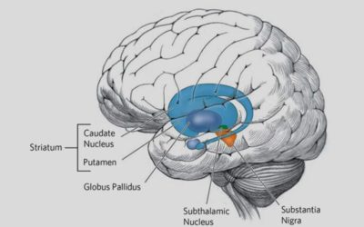 Kiwis Unlocking Secrets from Deep Inside of the Huntington’s Brain